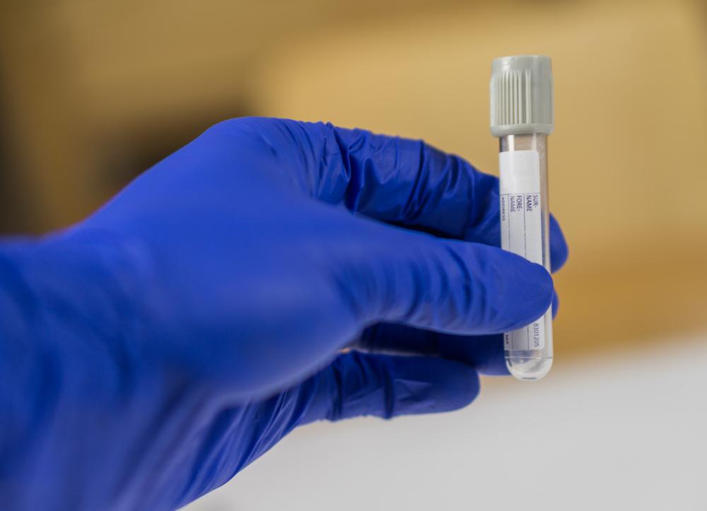 Whole Genome Sequences (WGS) analysis